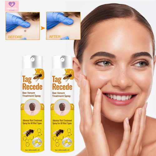 Tag Recede™ - ¡Dile adiós a las verrugas sin dolor!