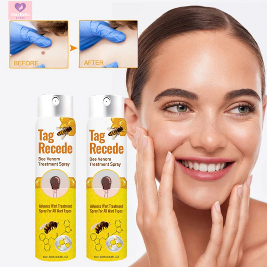 Tag Recede™ - ¡Dile adiós a las verrugas sin dolor!