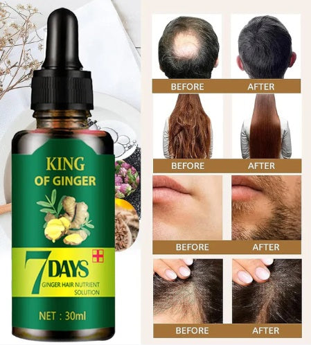 SERUM JENGIBRE ANTI CAIDA Y CRECIMIENTO ACELERADO 7DAYS™