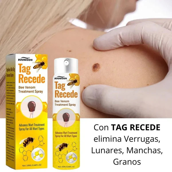 Tag Recede™ - ¡Dile adiós a las verrugas sin dolor!