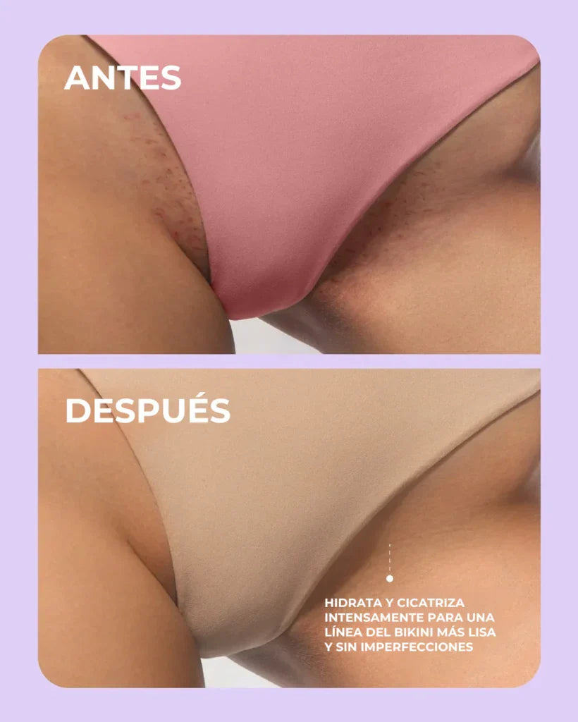 Aceite Truly® | Despídete de manchas, ardor y enrojecimiento