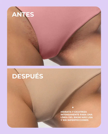 Aceite Truly® | Despídete de manchas, ardor y enrojecimiento