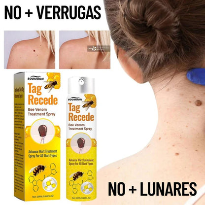 Tag Recede™ - ¡Dile adiós a las verrugas sin dolor!