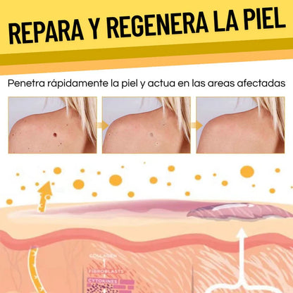 Tag Recede™ - ¡Dile adiós a las verrugas sin dolor!